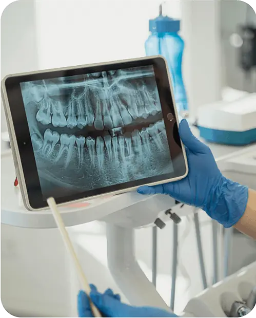A dentist reviewing dental X rays on a tablet